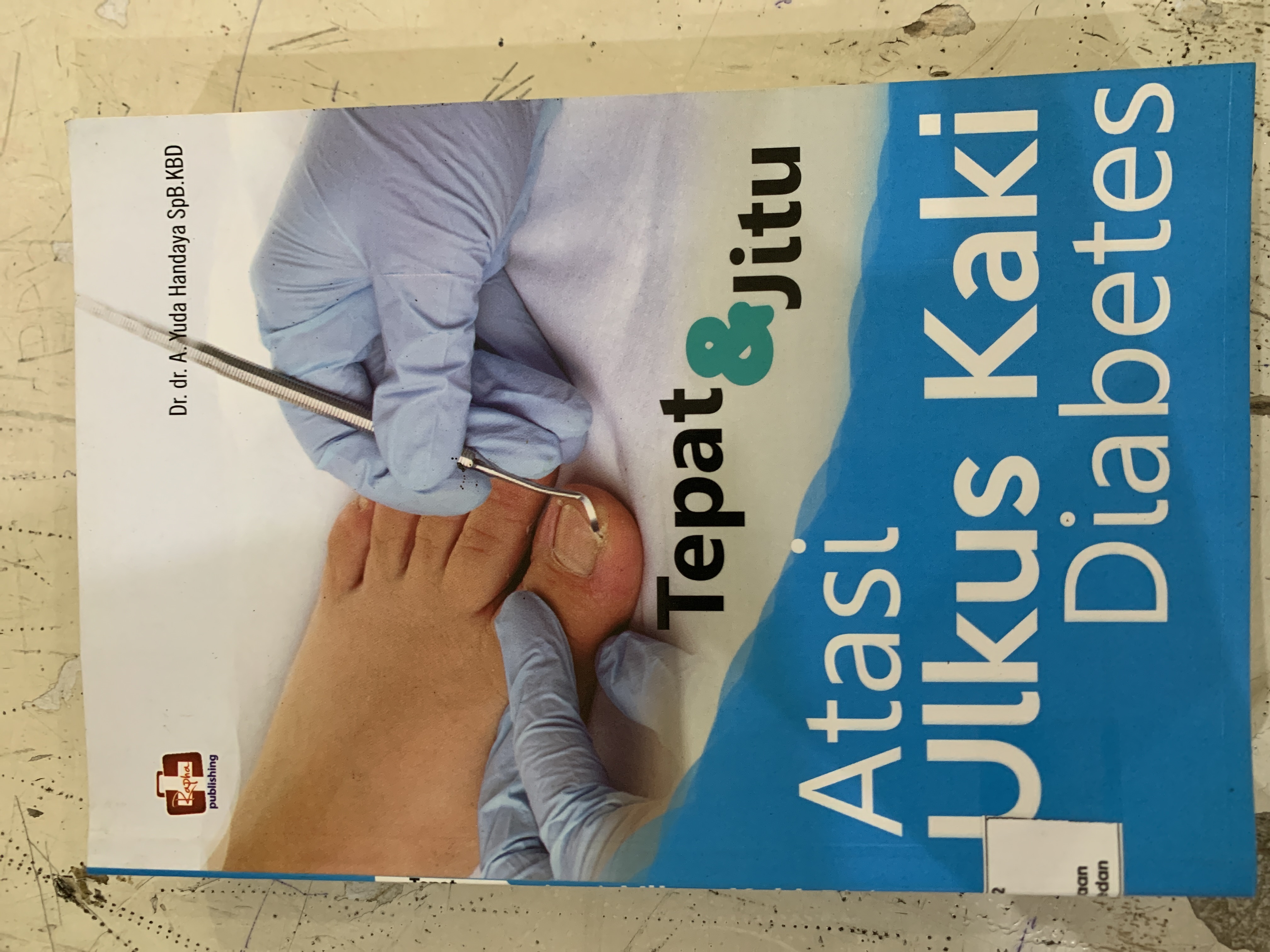 Tepat &amp; jitu Atasi Ulkus Kaki Diabetes